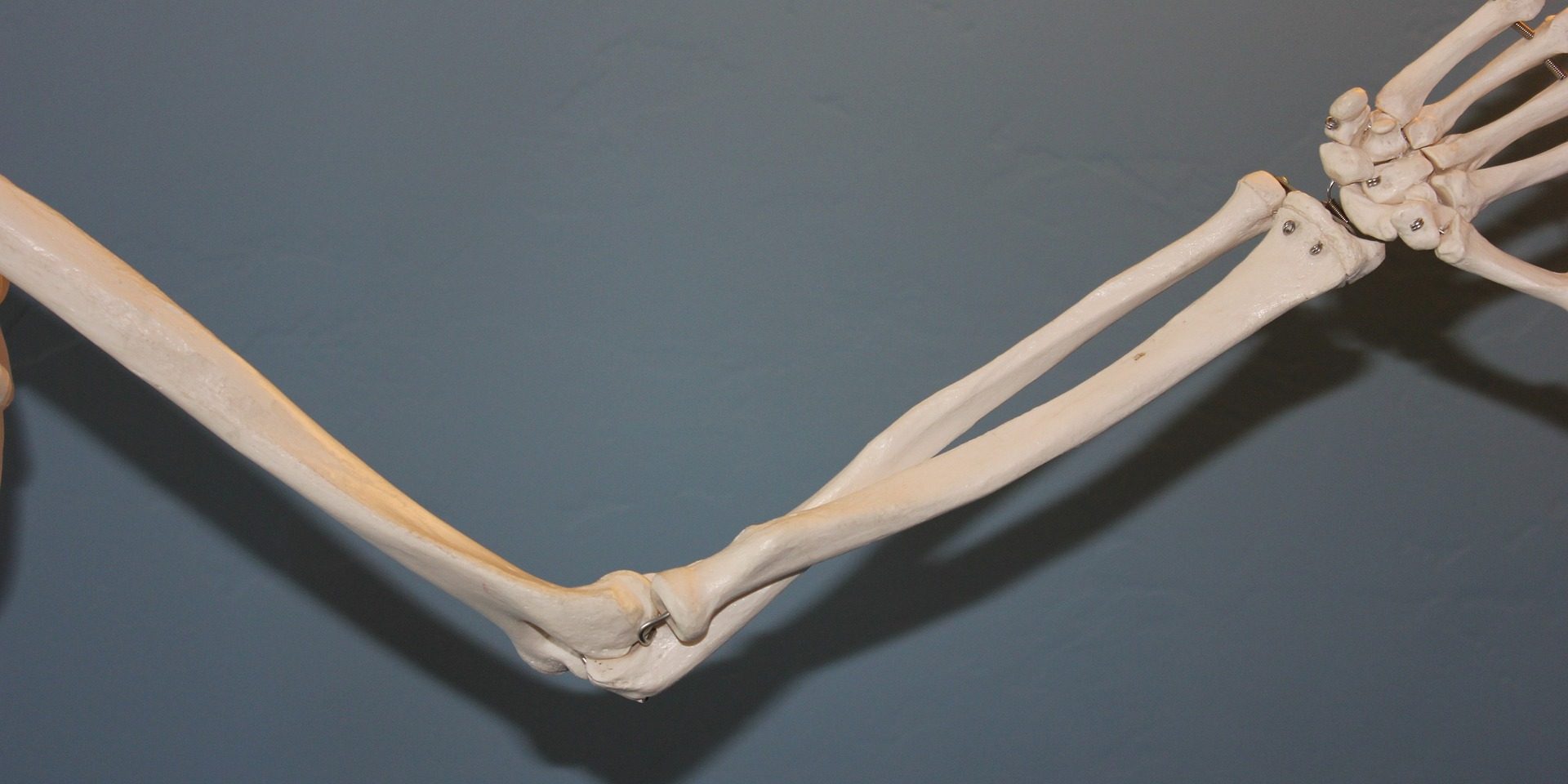 arm skelet Arm smerter