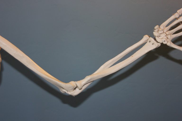 arm skelet Arm smerter